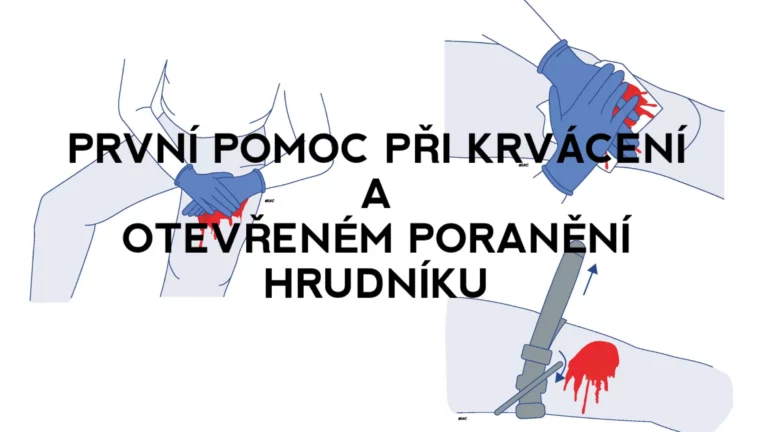 Článek: První pomoc při krvácení a otevřeném poranění hrudníku.
